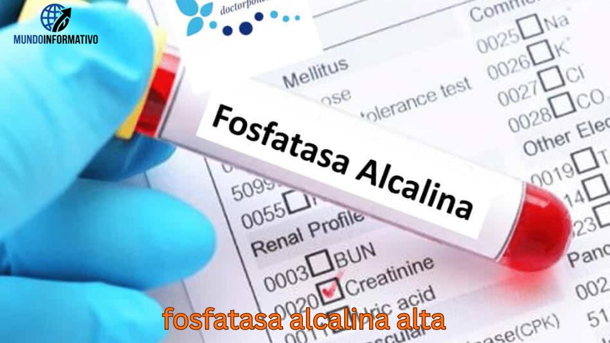 fosfatasa alcalina alta fosfatasa alcalina alta